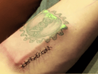implant-biohacker.png