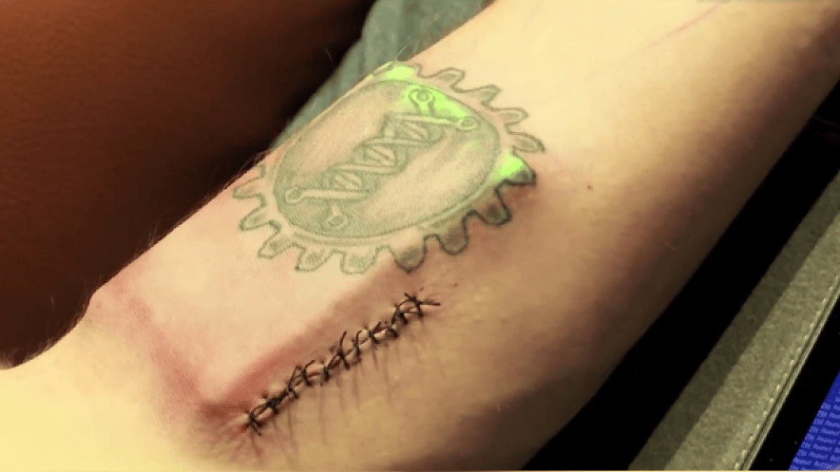 implant-biohacker.png implant-biohacker.png