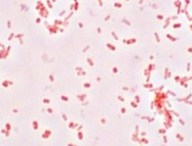 salmonella_typhimurium_gram.jpg