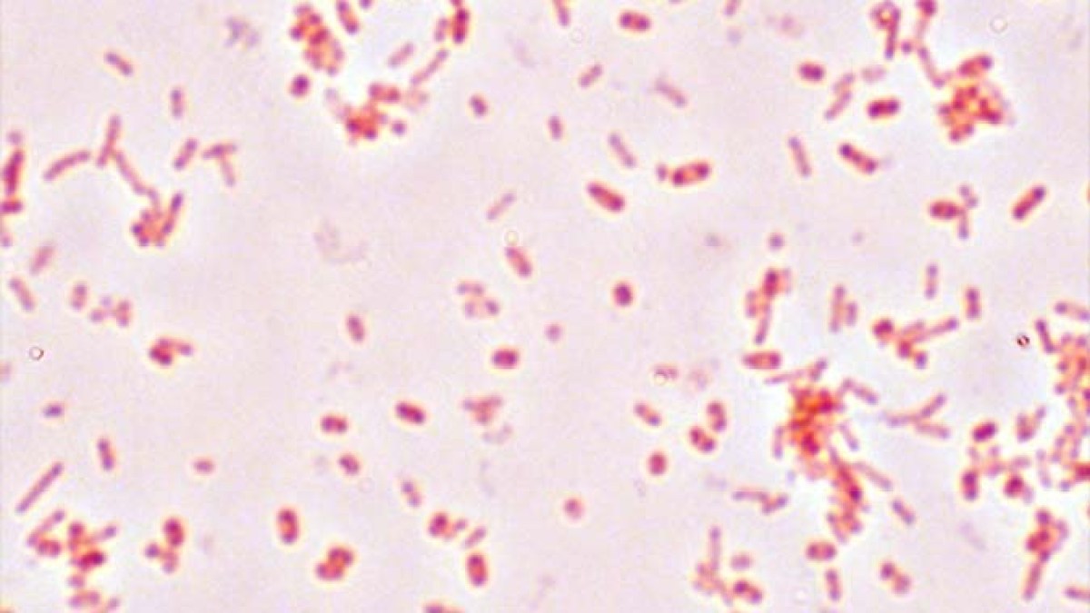 salmonella_typhimurium_gram.jpg salmonella_typhimurium_gram.jpg