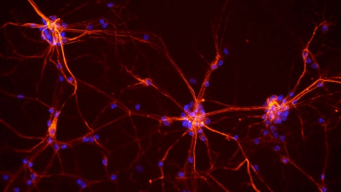 Neurones Neurones