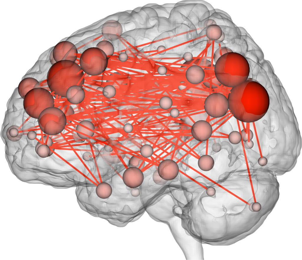 brain brain