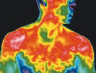 heat-body