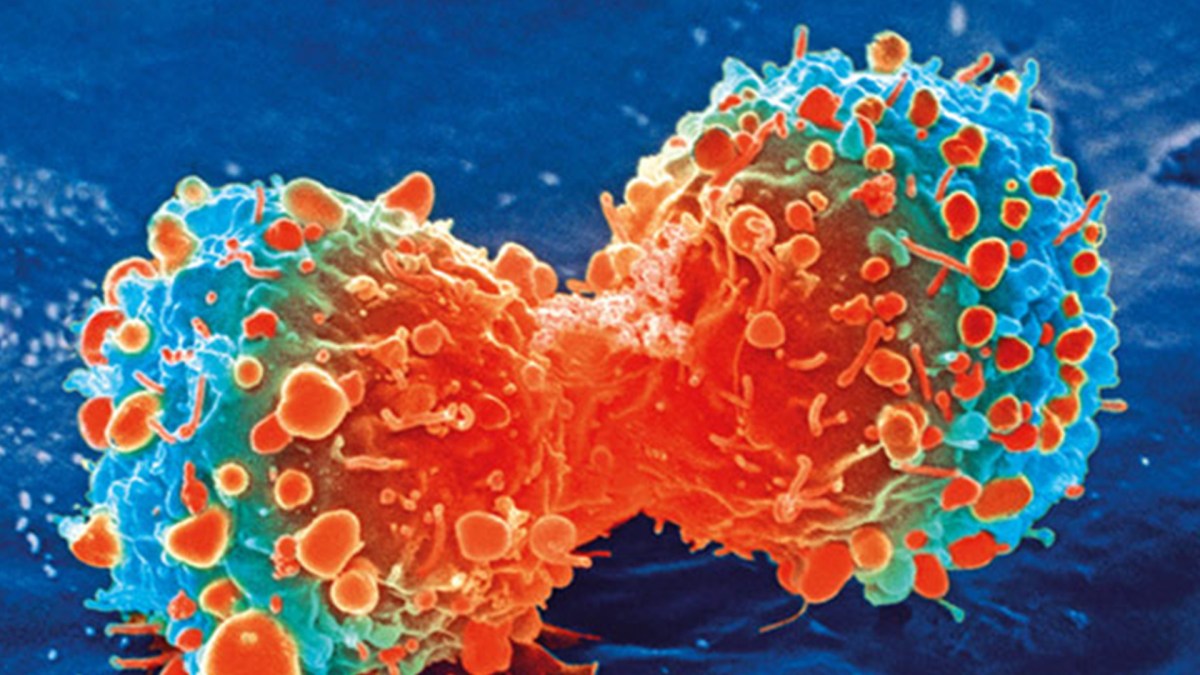 cancer cancer