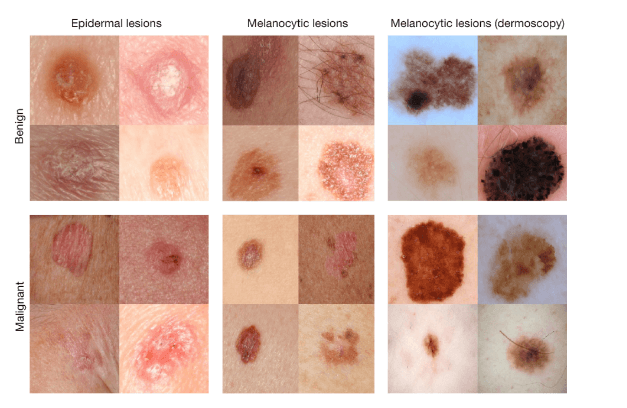 nature-cancer-peau nature-cancer-peau