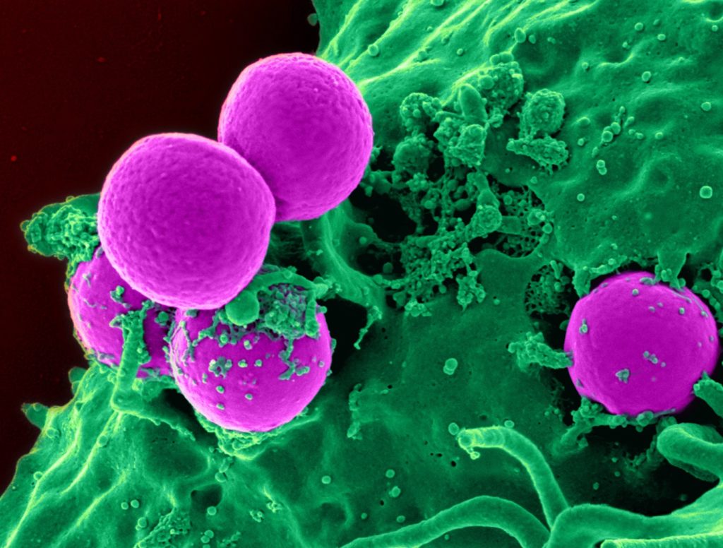white-blood-cell-cell-blood-cell-blood-45239 white-blood-cell-cell-blood-cell-blood-45239
