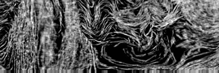 Vue des fibres entrelacées, obtenue en coupe par analyse tomographique, d'une partie d'un papyrus enroulé. Vue des fibres entrelacées, obtenue en coupe par analyse tomographique, d'une partie d'un papyrus enroulé.