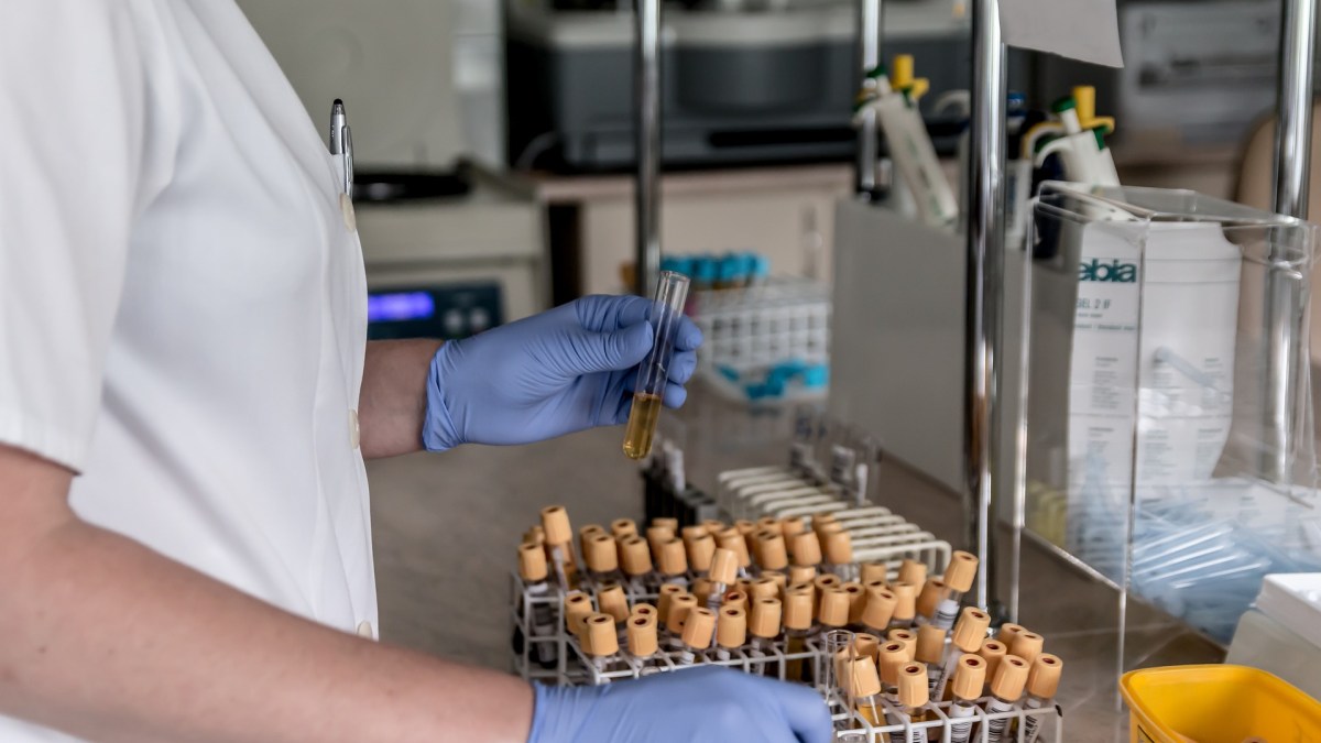 santé laboratoire médecine cancer santé laboratoire médecine cancer