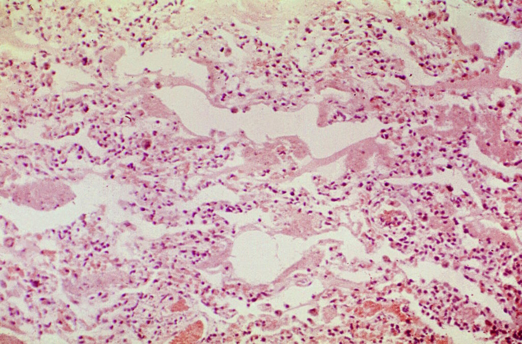 La bactérie Bacillus // Source : Pixnio/CC0