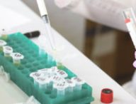 Des tests en laboratoire. // Source : Pixabay/CC0 (photo recadrée)