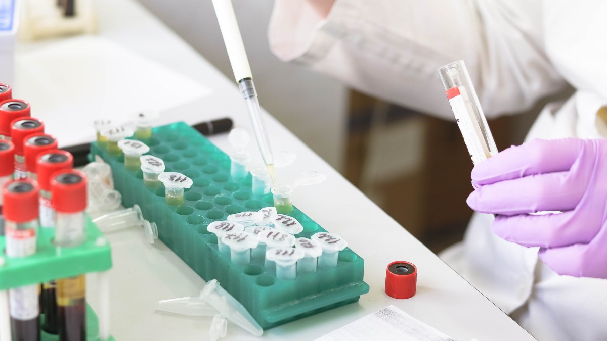 Des tests en laboratoire. // Source : Pixabay/CC0 (photo recadrée) Des tests en laboratoire. // Source : Pixabay/CC0 (photo recadrée)