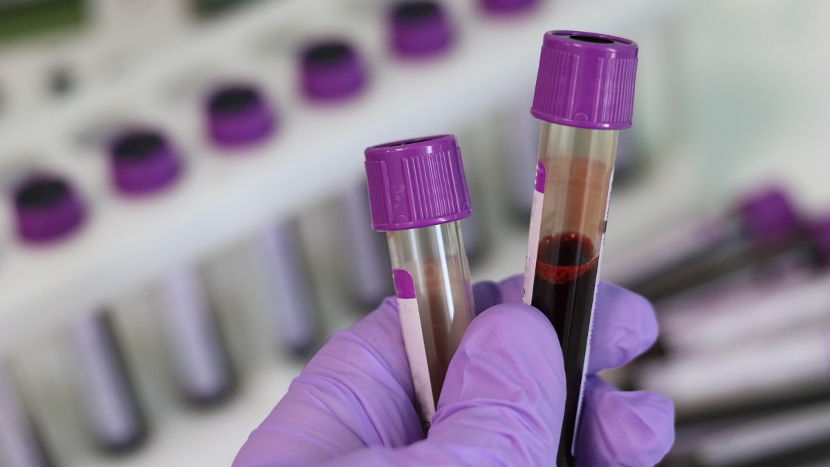 Des analyses dans un laboratoire. // Source : Pixabay/CC0 (photo recadrée) Des analyses dans un laboratoire. // Source : Pixabay/CC0 (photo recadrée)