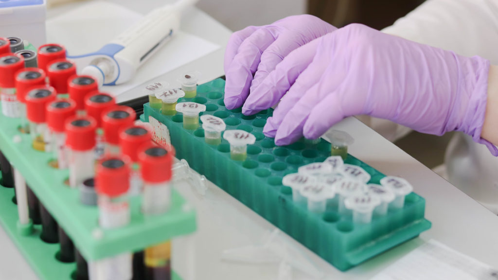Le test permettrait de dépister un cancer en moins de 10 minutes. // Source : Pixabay/CC0 (photo recadrée) Le test permettrait de dépister un cancer en moins de 10 minutes. // Source : Pixabay/CC0 (photo recadrée)