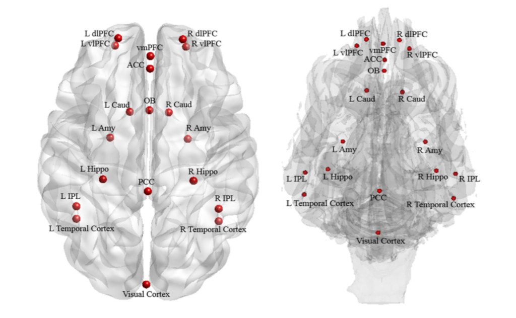 Les zones du cerveau activées dans le cerveau des chiens, comparées à celles des humains. // Source : Thompkins, A.M., Ramaiahgari, B., Zhao, S. et al. Learn Behav Les zones du cerveau activées dans le cerveau des chiens, comparées à celles des humains. // Source : Thompkins, A.M., Ramaiahgari, B., Zhao, S. et al. Learn Behav