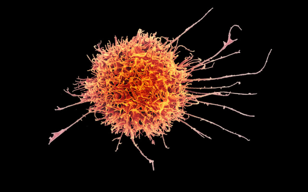 Une cellule NK. // Source : Flickr/CC/NIAID (photo recadrée) Une cellule NK. // Source : Flickr/CC/NIAID (photo recadrée)