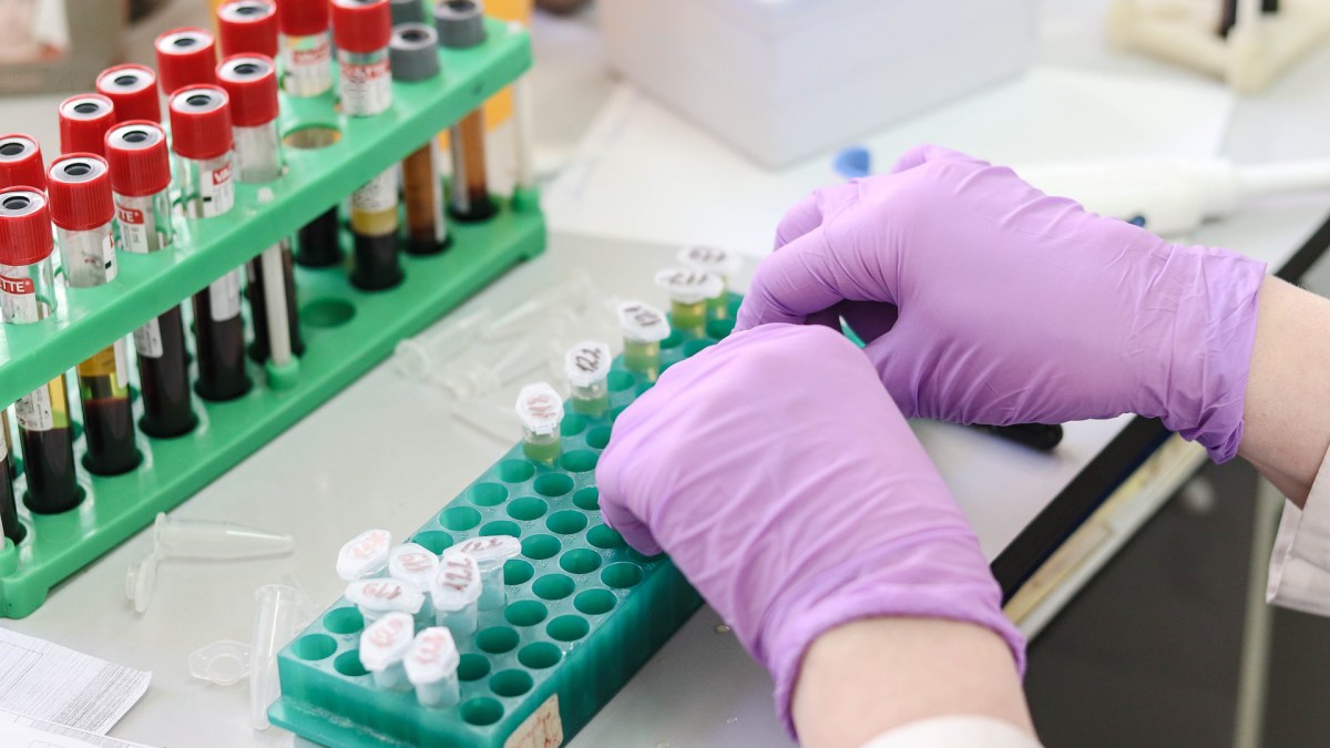 Des tests en laboratoire. // Source : Pixabay (photo recadrée) Des tests en laboratoire. // Source : Pixabay (photo recadrée)