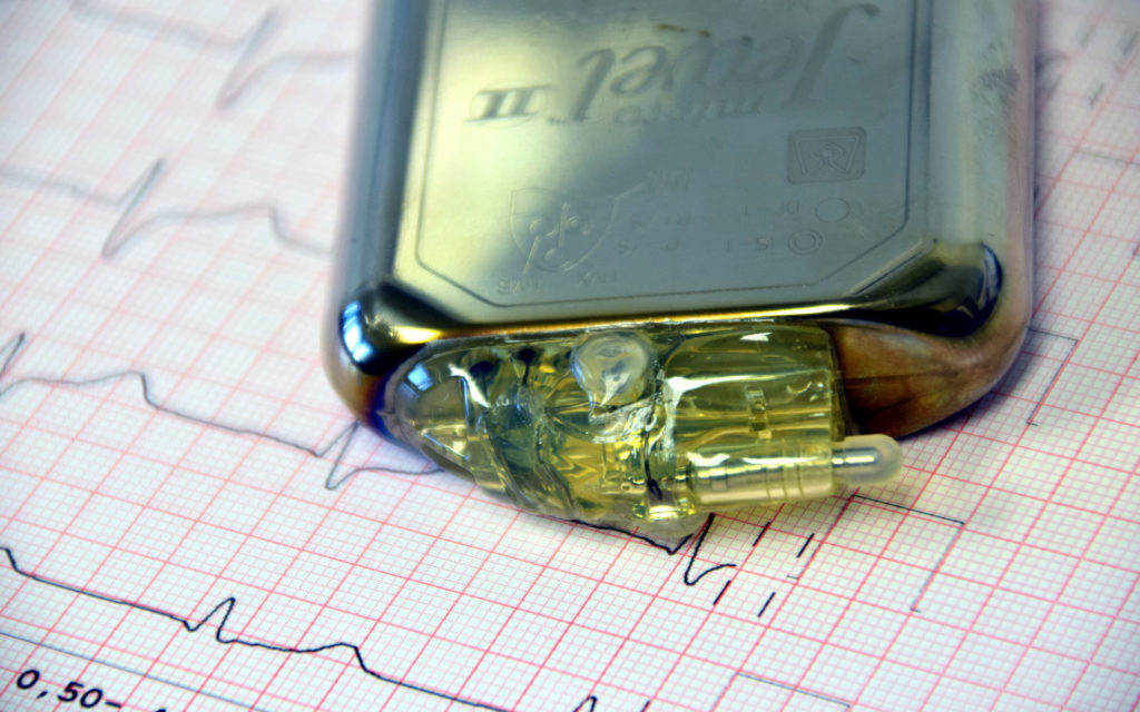 Un stimulateur cardiaque. // Source : Pixabay (photo recadrée) Un stimulateur cardiaque. // Source : Pixabay (photo recadrée)