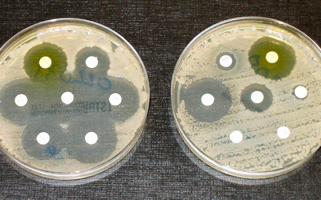 Des tests de résistance aux antibiotiques. // Source : Wikimedia/CC/Dr Graham Beards (photo recadrée) Des tests de résistance aux antibiotiques. // Source : Wikimedia/CC/Dr Graham Beards (photo recadrée)