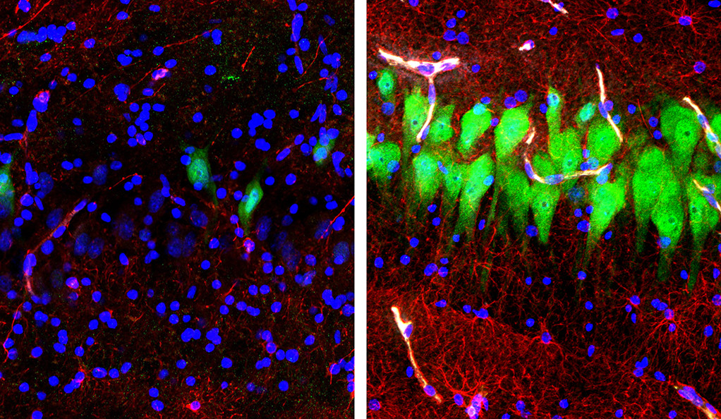 À gauche, un cerveau non traité 10 heures après le décès. À droite, le cerveau traité par les neuroscientifiques. // Source : Stefano G. Daniele & Zvonimir Vrselja; Sestan Laboratory; Yale School of Medicine À gauche, un cerveau non traité 10 heures après le décès. À droite, le cerveau traité par les neuroscientifiques. // Source : Stefano G. Daniele & Zvonimir Vrselja; Sestan Laboratory; Yale School of Medicine