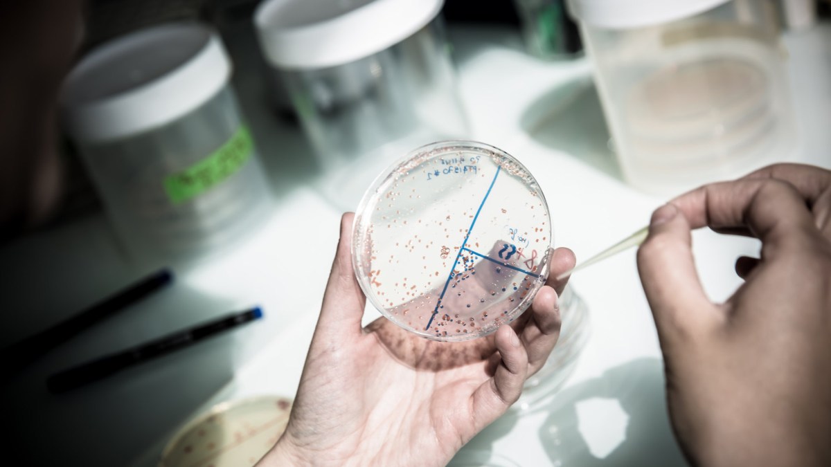 Une expérience de microbiologie. // Source : Flickr/CC/École polytechnique (photo recadrée) Une expérience de microbiologie. // Source : Flickr/CC/École polytechnique (photo recadrée)
