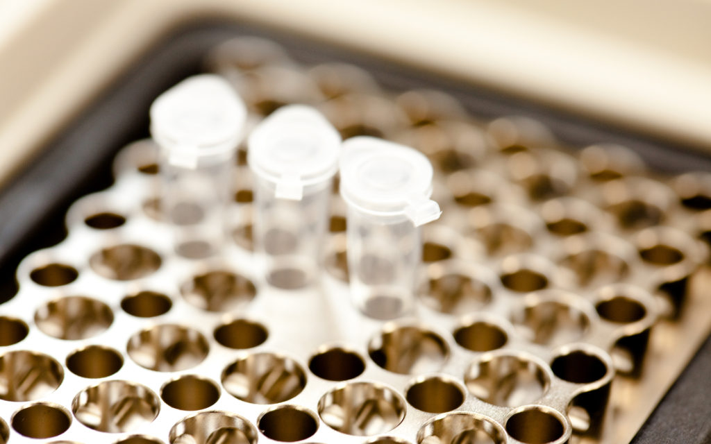 Des flacons dans un laboratoire. // Source : Flickr/CC/ibbl (photo recadrée) Des flacons dans un laboratoire. // Source : Flickr/CC/ibbl (photo recadrée)