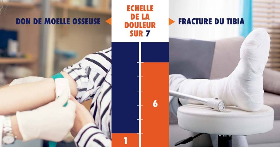 Le don de moelle osseuse est-il douloureux ? // Source : Don de moelle osseuse via Facebook Le don de moelle osseuse est-il douloureux ? // Source : Don de moelle osseuse via Facebook