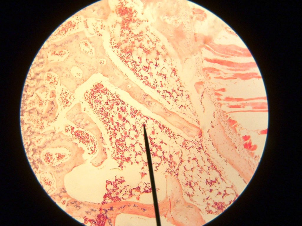 La moelle osseuse vu au microscope. // Source : Wikimedia/CC/Andrjusgeo La moelle osseuse vu au microscope. // Source : Wikimedia/CC/Andrjusgeo