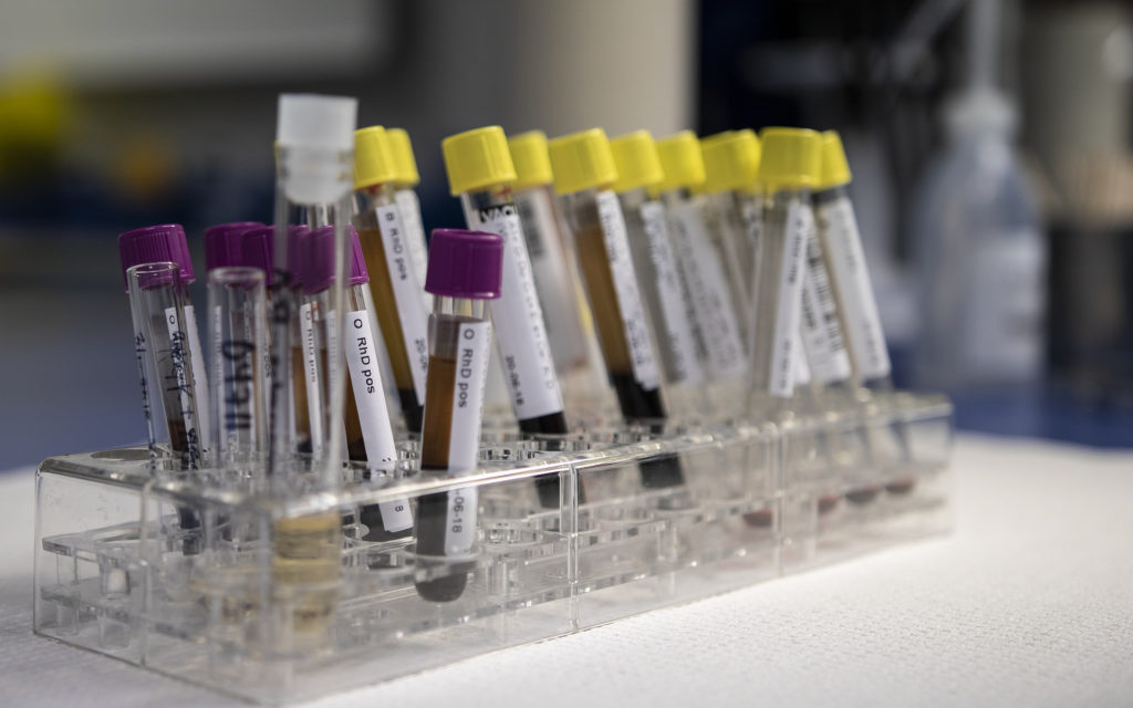 20 ans d'études scientifiques remis en cause. // Source : Pixabay (photo recadrée) 20 ans d'études scientifiques remis en cause. // Source : Pixabay (photo recadrée)
