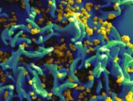 Une cellule infectée par le VIH. // Source : National Institutes of Health