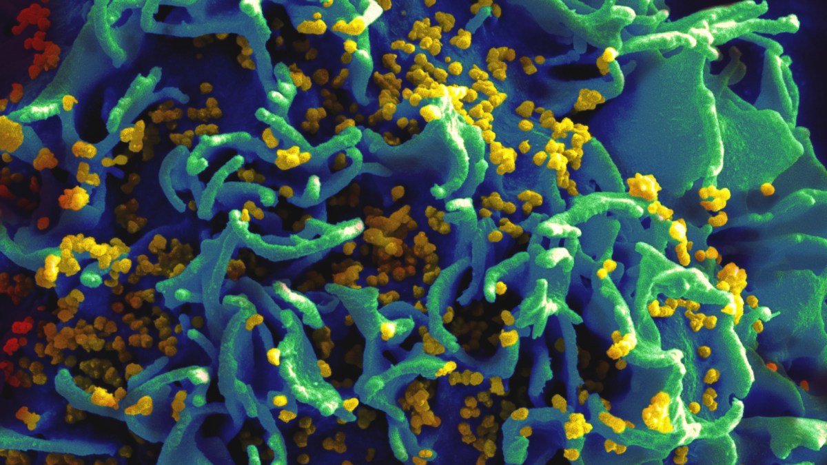 Une cellule infectée par le VIH. // Source : National Institutes of Health Une cellule infectée par le VIH. // Source : National Institutes of Health