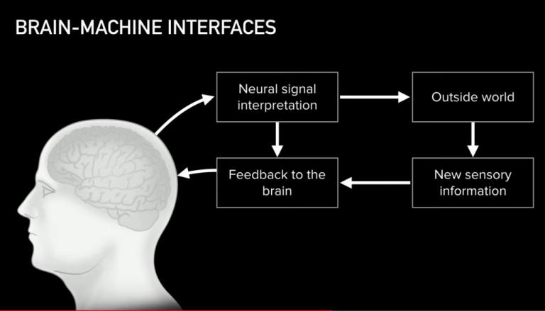 Présentation de l'interface Neuralink. // Source : Capture Youtube / Neuralink Présentation de l'interface Neuralink. // Source : Capture Youtube / Neuralink