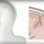 Capture Youtube / Neuralink