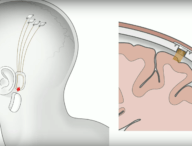 Capture Youtube / Neuralink