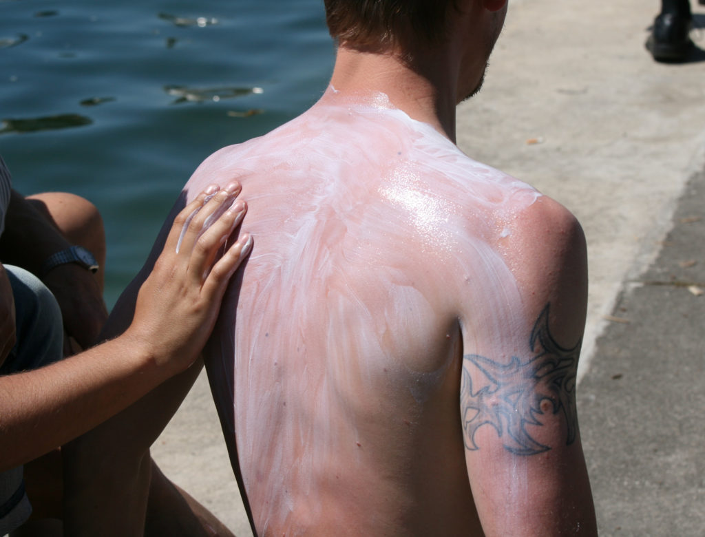 L'application de crème solaire laisse des traces blanches : quand il n'y en a pas, c'est le signe que le filtre est à base de nanoparticules, ce qui est plus nocif. // Source : Flickr/CC/NicolasR