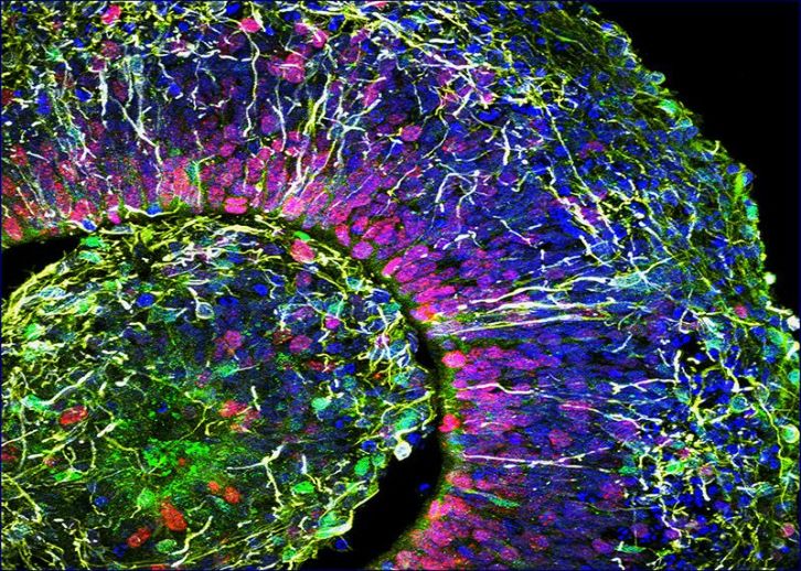 Une vue au sein du réseau neuronal d'un mini-cerveau. // Source : Muotri Lab/UC San Diego Une vue au sein du réseau neuronal d'un mini-cerveau. // Source : Muotri Lab/UC San Diego