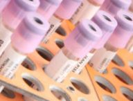 Échantillons en laboratoire. // Source : Pixabay (photo recadrée)