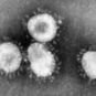 Image d'un coronavirus (ici celui qui provoque le Syndrome respiratoire aigu sévère). Le terme signifie « virus à couronne », car le virus est entouré d'une petit couronne de projections bulbeuses comme on peut le voir sur cette image au microscope. // Source : CDC 
