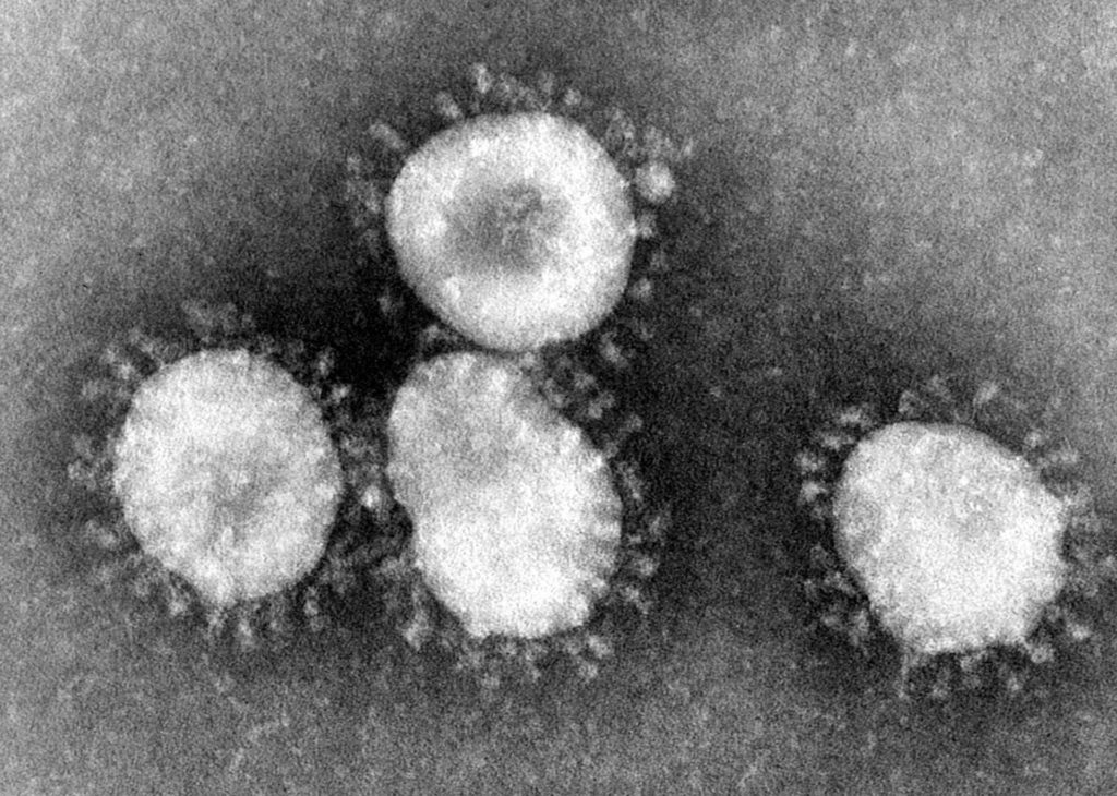 Image d'un coronavirus (ici celui qui provoque le Syndrome respiratoire aigu sévère). Le terme signifie « virus à couronne », car le virus est entouré d'une petit couronne de projections bulbeuses comme on peut le voir sur cette image au microscope. // Source : CDC Image d'un coronavirus (ici celui qui provoque le Syndrome respiratoire aigu sévère). Le terme signifie « virus à couronne », car le virus est entouré d'une petit couronne de projections bulbeuses comme on peut le voir sur cette image au microscope. // Source : CDC