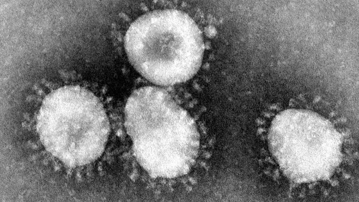 Image d'un coronavirus (ici celui qui provoque le Syndrome respiratoire aigu sévère). Le terme signifie « virus à couronne », car le virus est entouré d'une petit couronne de projections bulbeuses comme on peut le voir sur cette image au microscope. // Source : CDC Image d'un coronavirus (ici celui qui provoque le Syndrome respiratoire aigu sévère). Le terme signifie « virus à couronne », car le virus est entouré d'une petit couronne de projections bulbeuses comme on peut le voir sur cette image au microscope. // Source : CDC