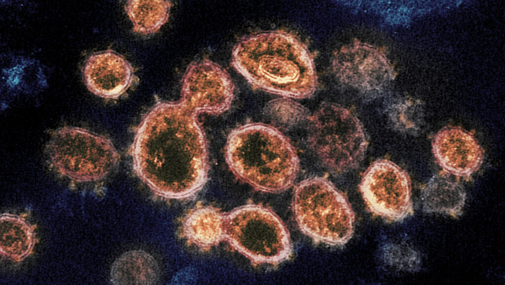 Le SARS-CoV-2 vu par microscope électronique en transmission. // Source : NIAID-RML Le SARS-CoV-2 vu par microscope électronique en transmission. // Source : NIAID-RML