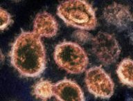 Le SARS-CoV-2 vu par microscope électronique en transmission. // Source : NIAID-RML