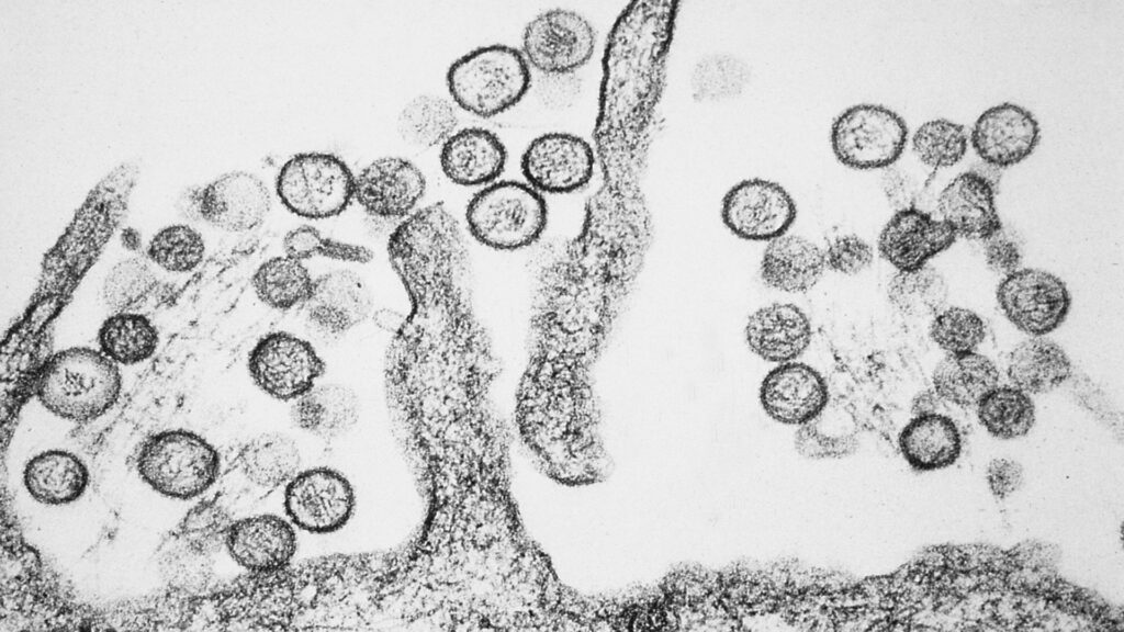 Image au microscope d'un hantavirus. Image au microscope d'un hantavirus.