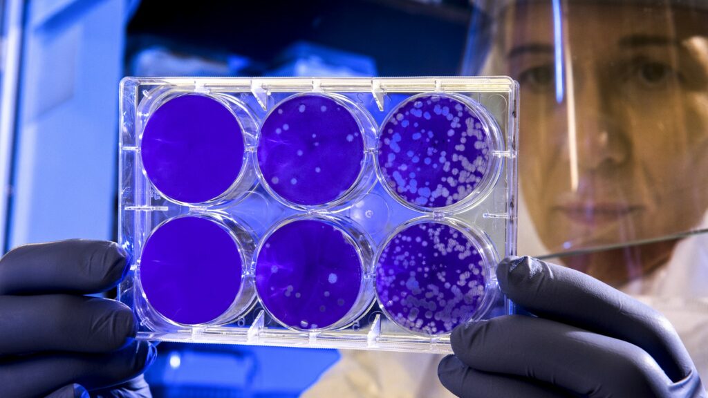 L'étude d'échantillons de différents coronavirus permet de retracer une chaîne évolutive ayant mené à SARS-CoV-2. // Source : PxHere L'étude d'échantillons de différents coronavirus permet de retracer une chaîne évolutive ayant mené à SARS-CoV-2. // Source : PxHere