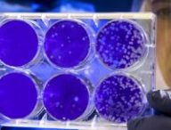 L'étude d'échantillons de différents coronavirus permet de retracer une chaîne évolutive ayant mené à SARS-CoV-2. // Source : PxHere
