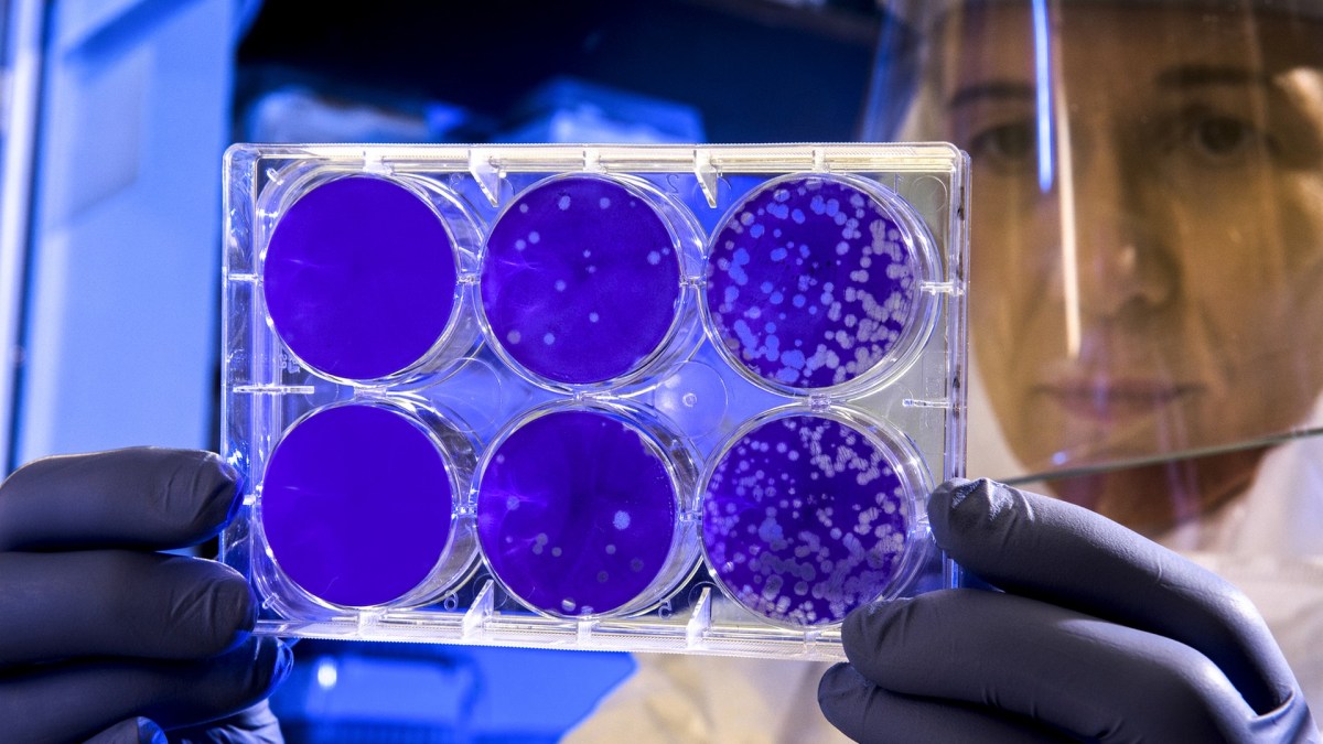 L'étude d'échantillons de différents coronavirus permet de retracer une chaîne évolutive ayant mené à SARS-CoV-2. // Source : PxHere L'étude d'échantillons de différents coronavirus permet de retracer une chaîne évolutive ayant mené à SARS-CoV-2. // Source : PxHere