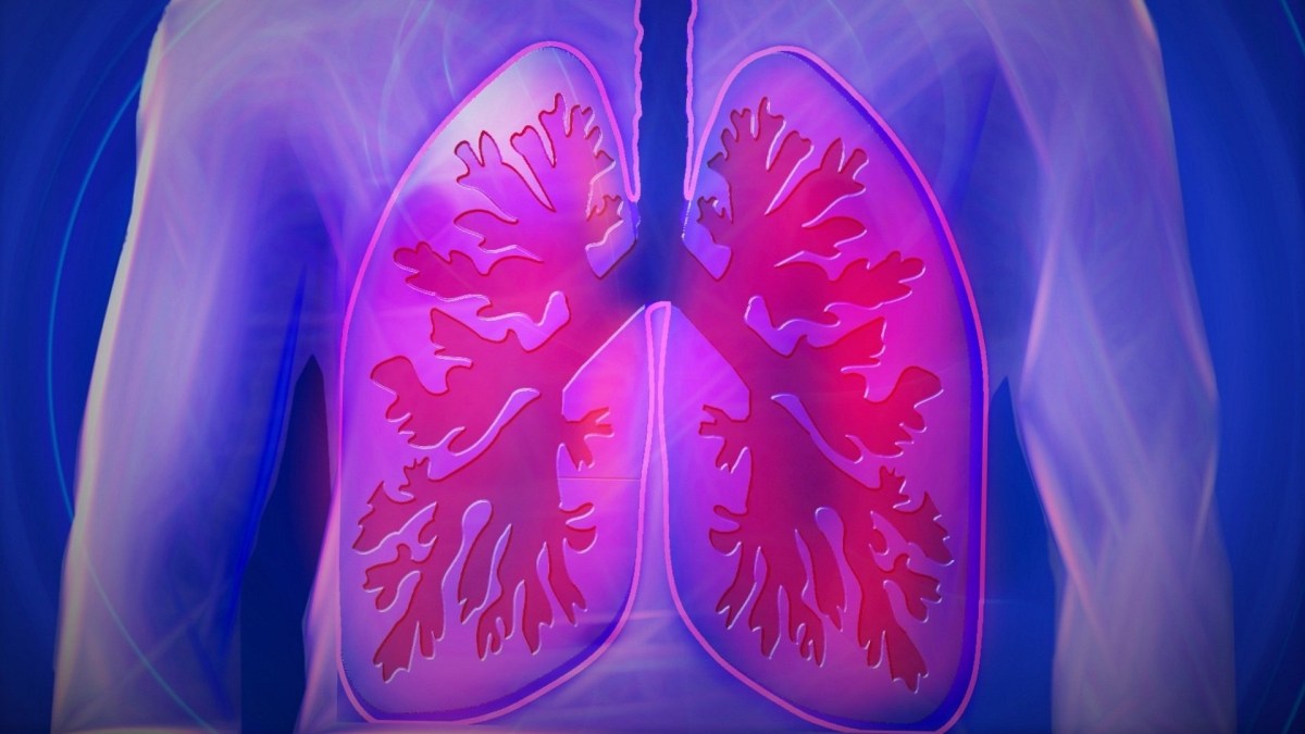 Covid-19 est une pneumonie : elle s'attaque essentiellement aux poumons dans un premier temps. // Source : Pixabay Covid-19 est une pneumonie : elle s'attaque essentiellement aux poumons dans un premier temps. // Source : Pixabay