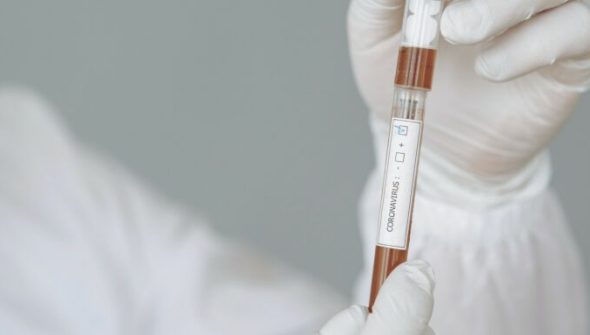 Coronavirus. Maladie Covid-19. // Source : Pexels