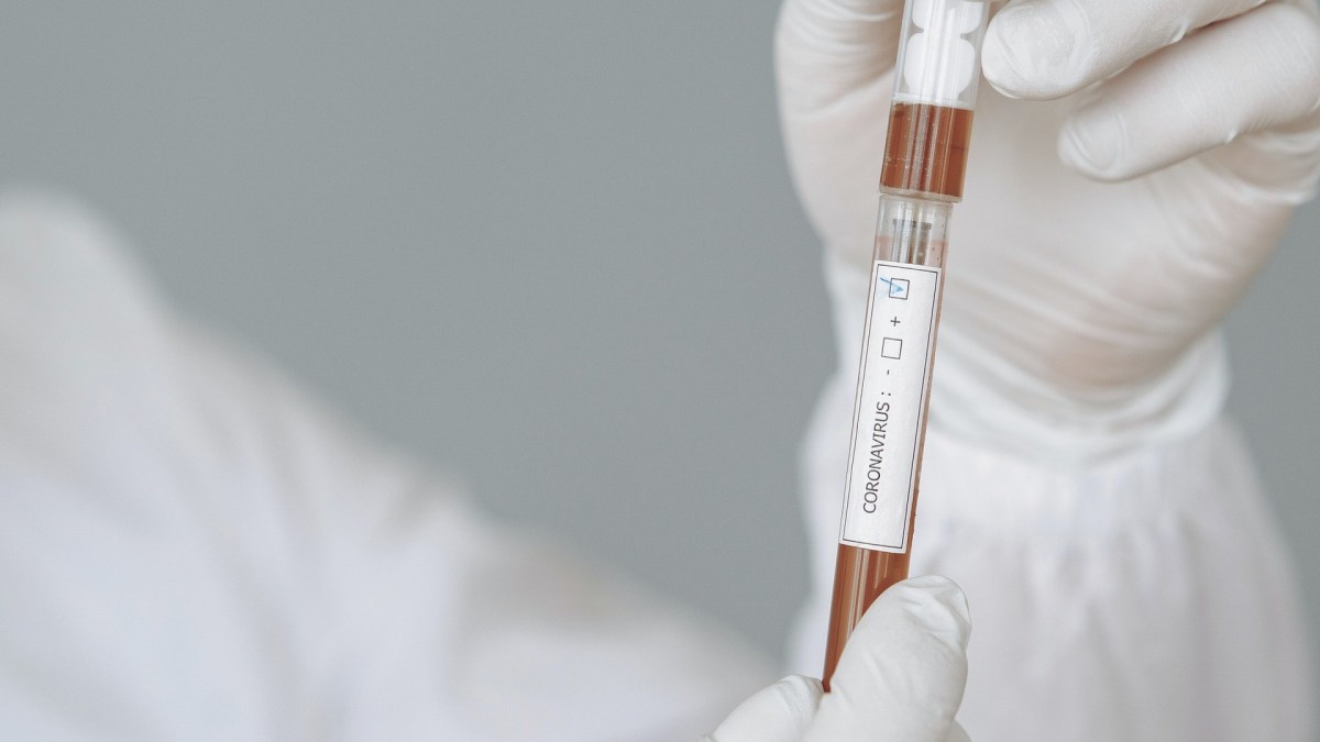 Coronavirus. Maladie Covid-19. // Source : Pexels Coronavirus. Maladie Covid-19. // Source : Pexels