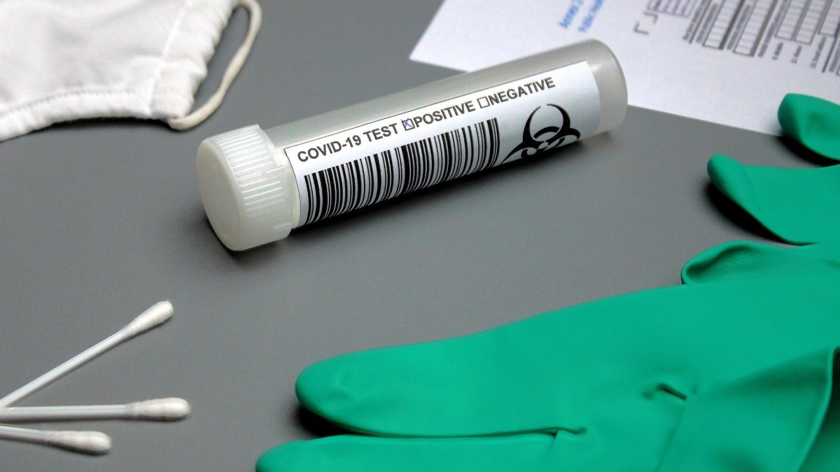 test covid coronavirus // Source : Pixabay test covid coronavirus // Source : Pixabay