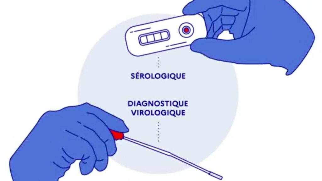 Le test PCR est un prélèvement nasal, et le test antigénique également. // Source : Gouvernement Le test PCR est un prélèvement nasal, et le test antigénique également. // Source : Gouvernement